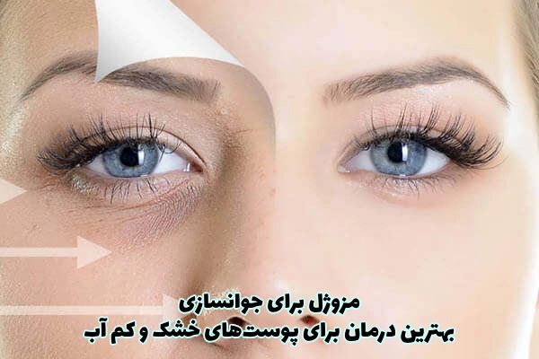 مزوژل برای جوانسازی